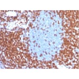 Immunohistochemistry - Anti-CD3 epsilon Antibody [C3e/4653R] (A278088) - Antibodies.com