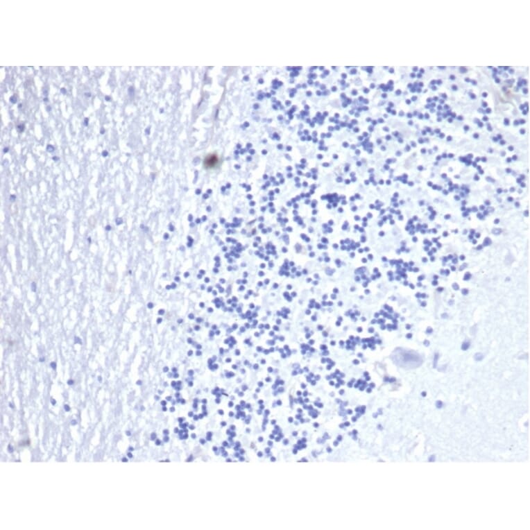 Immunohistochemistry - Anti-CD3 epsilon Antibody [C3e/4653R] (A278088) - Antibodies.com