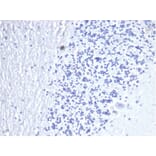Immunohistochemistry - Anti-CD3 epsilon Antibody [C3e/4653R] (A278088) - Antibodies.com