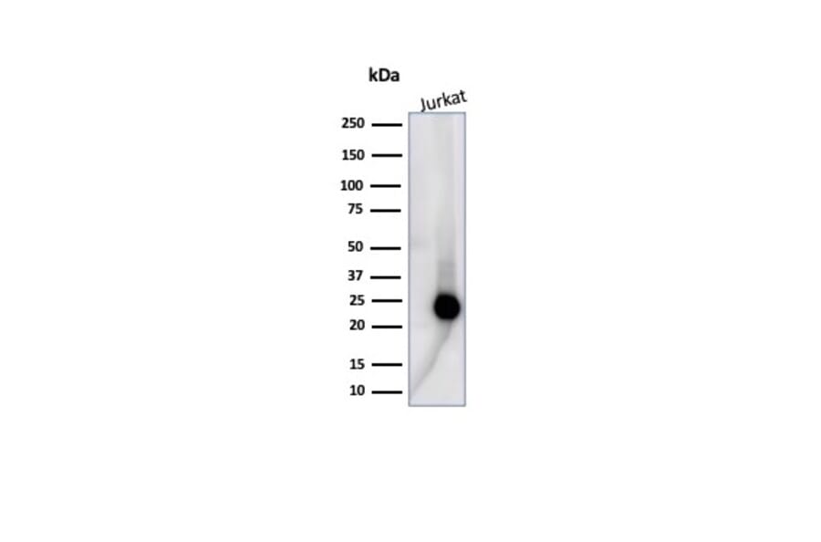 Western Blot - Anti-CD3 epsilon Antibody [C3e/4653R] (A278088) - Antibodies.com