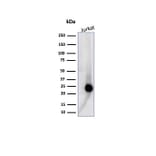 Western Blot - Anti-CD3 epsilon Antibody [C3e/4653R] (A278088) - Antibodies.com