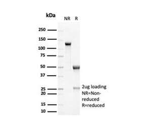 SDS-PAGE - Anti-RCAS1 Antibody [EBAG9/7033R] (A278089) - Antibodies.com