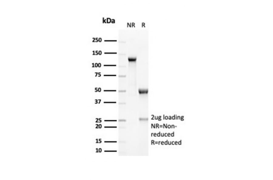SDS-PAGE - Anti-RCAS1 Antibody [EBAG9/7033R] (A278089) - Antibodies.com