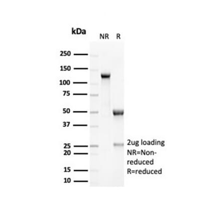 SDS-PAGE - Anti-RCAS1 Antibody [EBAG9/7033R] (A278089) - Antibodies.com