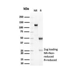 SDS-PAGE - Anti-RCAS1 Antibody [EBAG9/7033R] (A278089) - Antibodies.com