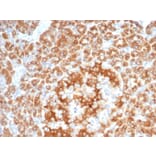 Immunohistochemistry - Anti-RCAS1 Antibody [EBAG9/7033R] (A278089) - Antibodies.com