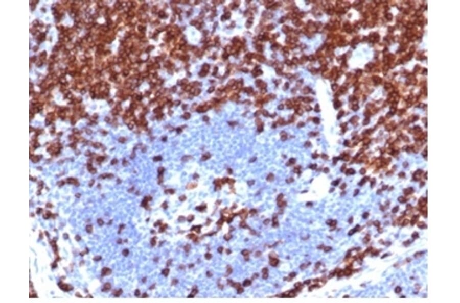 Immunohistochemistry - Anti-CD5 Antibody [C5/4561R] (A278090) - Antibodies.com