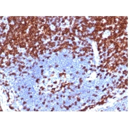 Immunohistochemistry - Anti-CD5 Antibody [C5/4561R] (A278090) - Antibodies.com