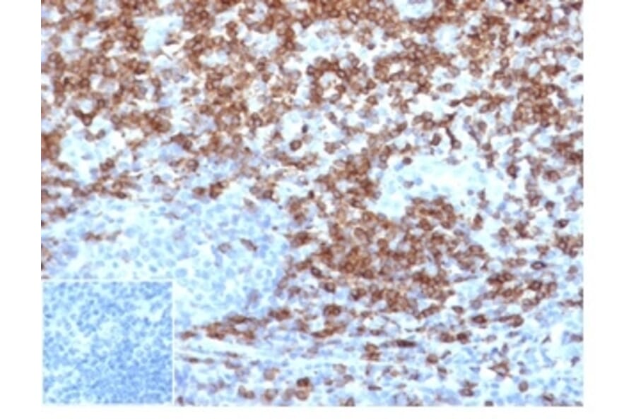 Immunohistochemistry - Anti-CD5 Antibody [C5/4561R] (A278090) - Antibodies.com