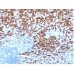 Immunohistochemistry - Anti-CD5 Antibody [C5/4561R] (A278090) - Antibodies.com