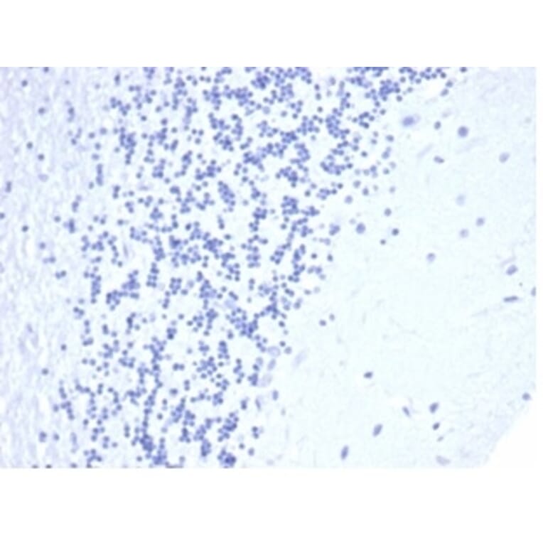 Immunohistochemistry - Anti-CD5 Antibody [C5/4561R] (A278090) - Antibodies.com