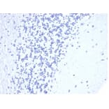 Immunohistochemistry - Anti-CD5 Antibody [C5/4561R] (A278090) - Antibodies.com