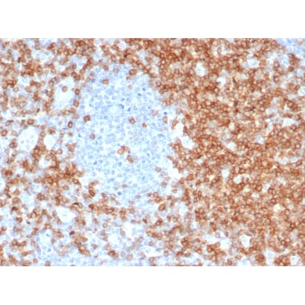 Immunohistochemistry - Anti-CD5 Antibody [C5/6463R] (A278091) - Antibodies.com