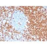 Immunohistochemistry - Anti-CD5 Antibody [C5/6463R] (A278091) - Antibodies.com