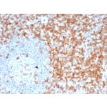 Immunohistochemistry - Anti-CD5 Antibody [C5/6463R] (A278091) - Antibodies.com