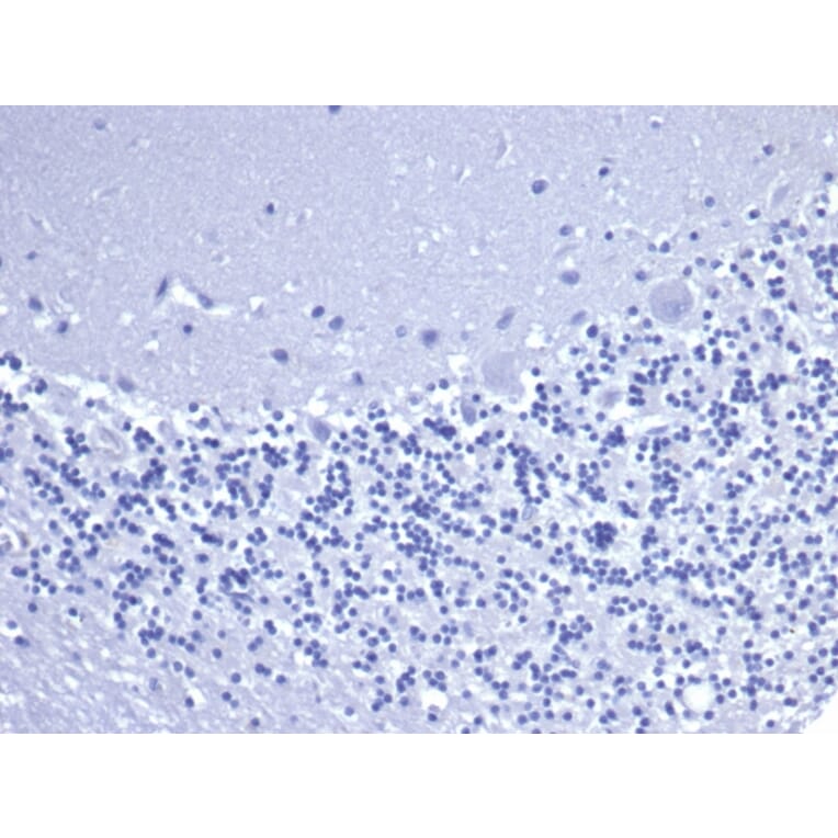 Immunohistochemistry - Anti-CD5 Antibody [C5/6463R] (A278091) - Antibodies.com