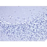 Immunohistochemistry - Anti-CD5 Antibody [C5/6463R] (A278091) - Antibodies.com