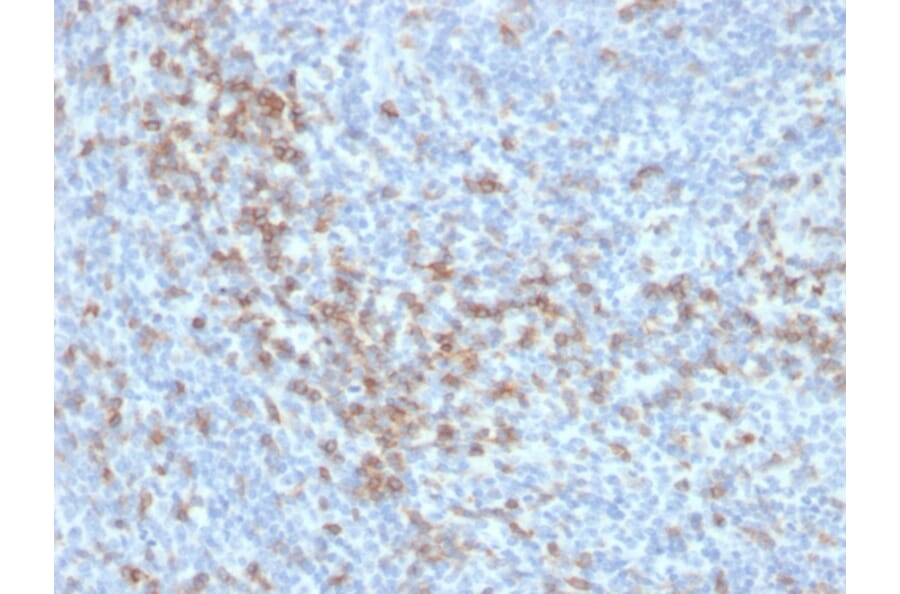 Immunohistochemistry - Anti-CD5 Antibody [C5/6438R] (A278092) - Antibodies.com