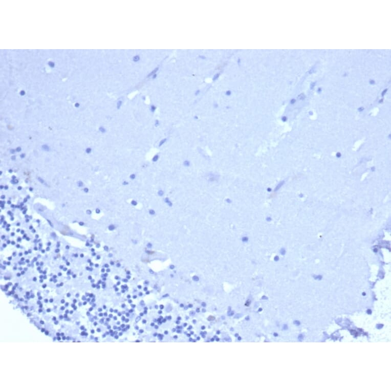 Immunohistochemistry - Anti-CD5 Antibody [C5/6438R] (A278092) - Antibodies.com