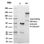 SDS-PAGE - Anti-CD5 Antibody [C5/6438R] (A278092) - Antibodies.com