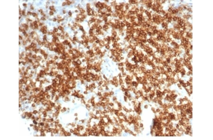 Immunohistochemistry - Anti-CD6 Antibody [C6/7022R] (A278094) - Antibodies.com