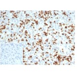 Immunohistochemistry - Anti-CD6 Antibody [C6/7022R] (A278094) - Antibodies.com