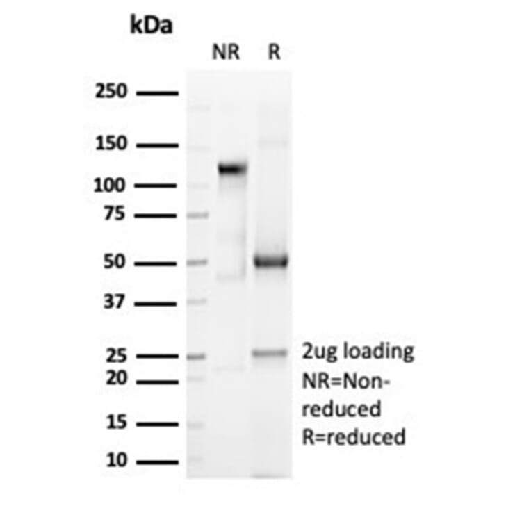 SDS-PAGE - Anti-CD6 Antibody [C6/7022R] (A278094) - Antibodies.com