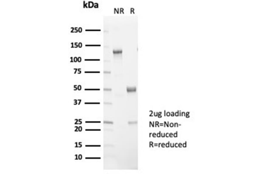 SDS-PAGE - Anti-L-PLUNC Antibody [LPLUNC1/7059R] (A278095) - Antibodies.com