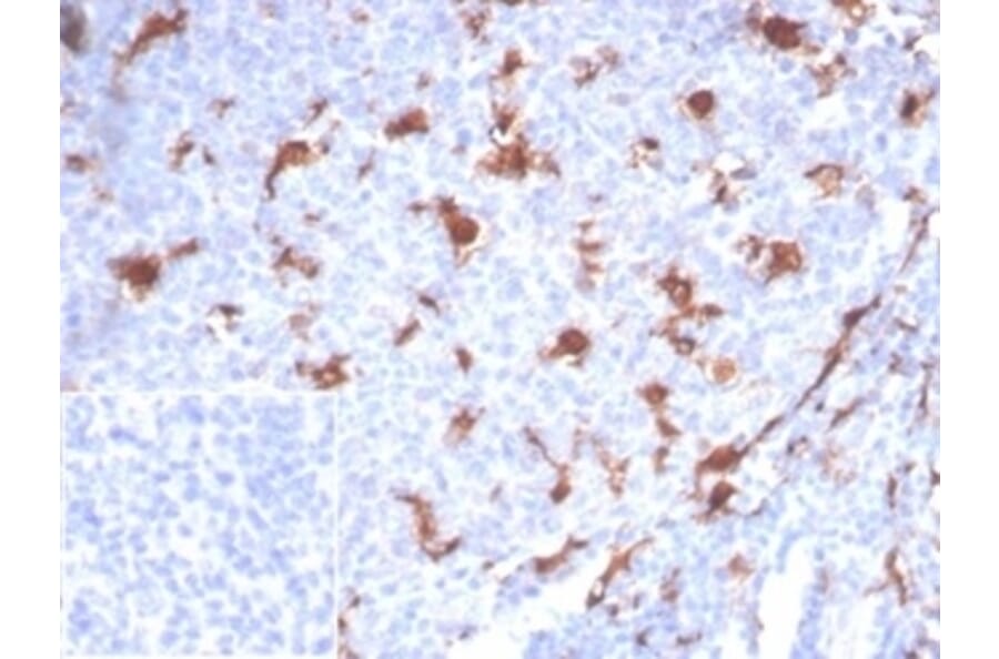 Immunohistochemistry - Anti-L-PLUNC Antibody [LPLUNC1/7059R] (A278095) - Antibodies.com