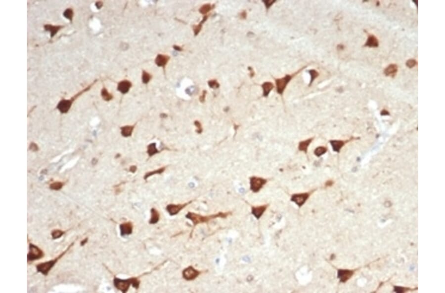 Immunohistochemistry - Anti-L-PLUNC Antibody [LPLUNC1/7059R] (A278095) - Antibodies.com