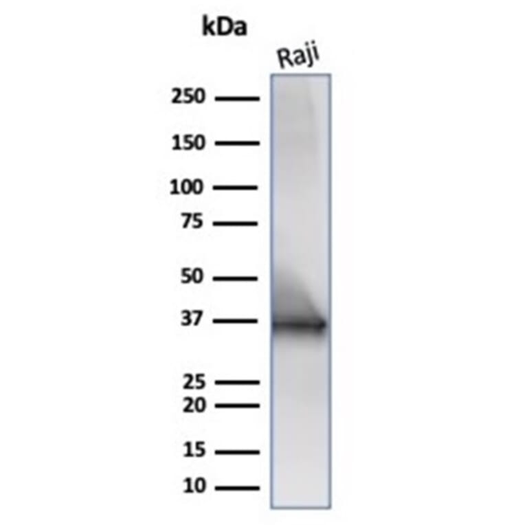 Western Blot - Anti-CD20 Antibody [IGEL/6850R] (A278096) - Antibodies.com