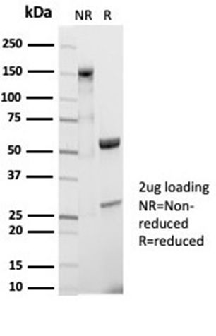 SDS-PAGE - Anti-CD20 Antibody [IGEL/7015R] (A278097) - Antibodies.com
