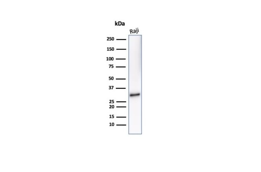 Western Blot - Anti-CD20 Antibody [IGEL/7015R] (A278097) - Antibodies.com