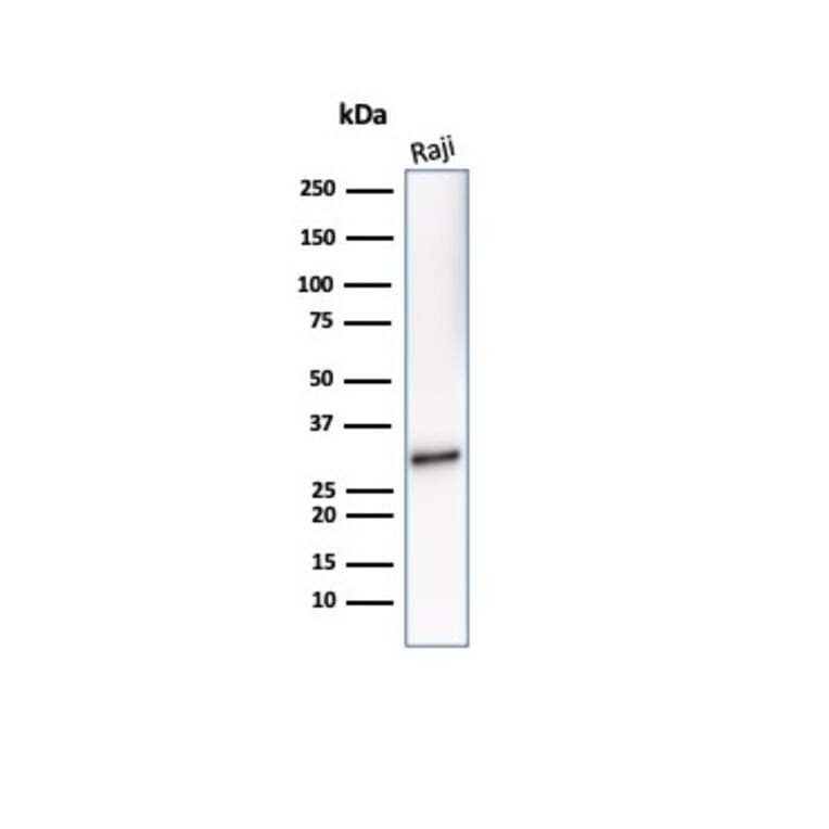 Western Blot - Anti-CD20 Antibody [IGEL/7015R] (A278097) - Antibodies.com