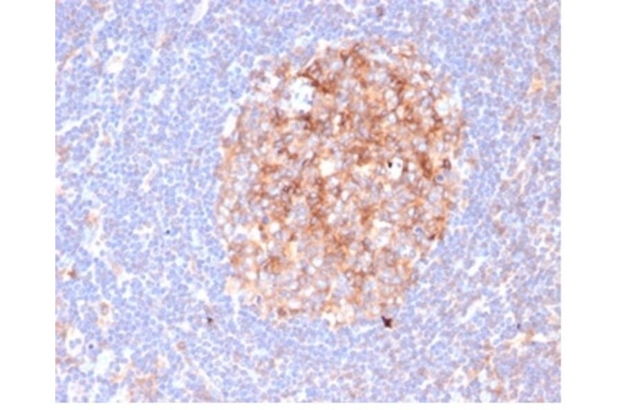 Immunohistochemistry - Anti-CD86 Antibody [C86/6500R] (A278098) - Antibodies.com