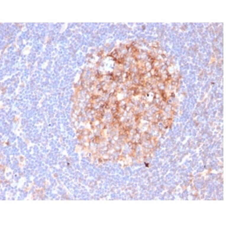Immunohistochemistry - Anti-CD86 Antibody [C86/6500R] (A278098) - Antibodies.com