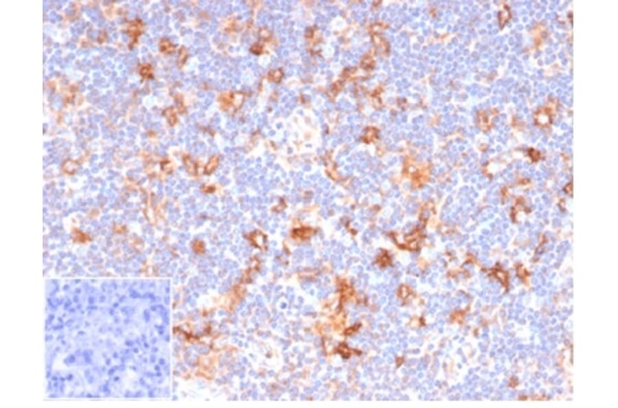 Immunohistochemistry - Anti-CD86 Antibody [C86/6500R] (A278098) - Antibodies.com