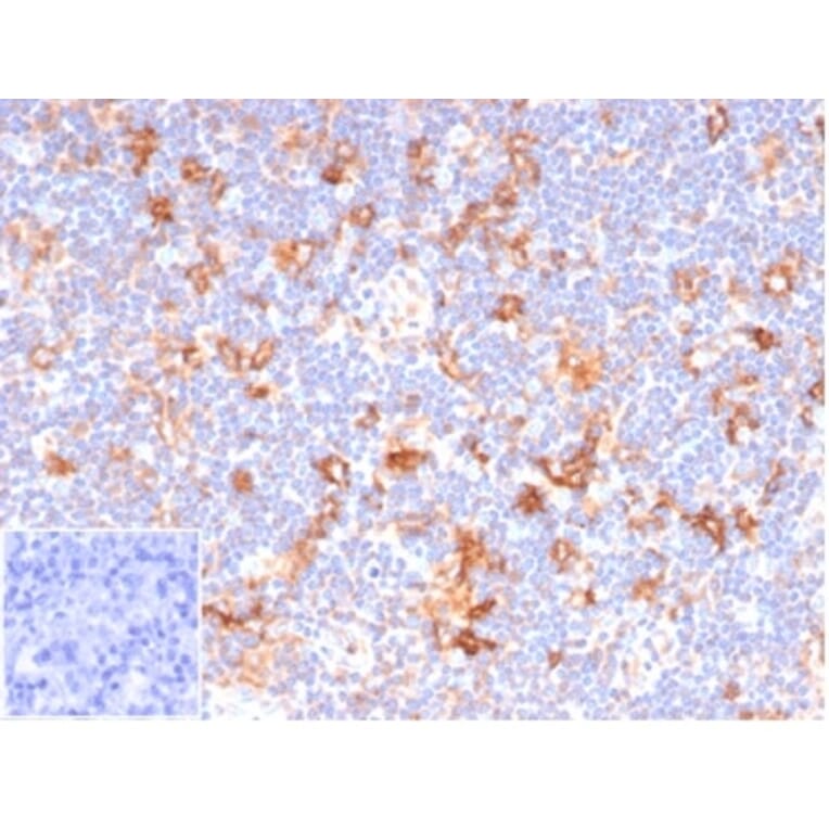 Immunohistochemistry - Anti-CD86 Antibody [C86/6500R] (A278098) - Antibodies.com