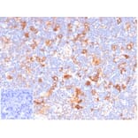 Immunohistochemistry - Anti-CD86 Antibody [C86/6500R] (A278098) - Antibodies.com