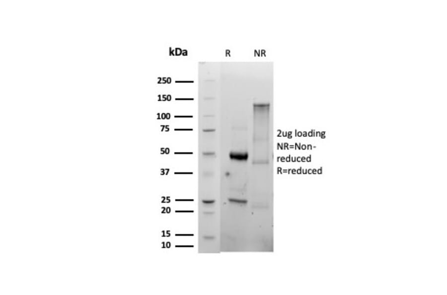 SDS-PAGE - Anti-CD86 Antibody [C86/6500R] (A278098) - Antibodies.com