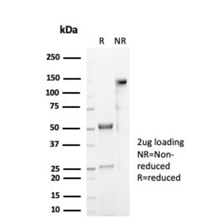 SDS-PAGE - Anti-CD59 Antibody [MACIF/7021R] (A278101) - Antibodies.com
