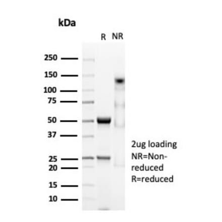 SDS-PAGE - Anti-CD74 Antibody [CLIP/7023R] (A278102) - Antibodies.com