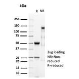 SDS-PAGE - Anti-CD74 Antibody [CLIP/7023R] (A278102) - Antibodies.com