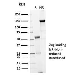 SDS-PAGE - Anti-CDC20 Antibody [CDC20/7026R] (A278103) - Antibodies.com