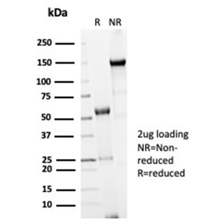 SDS-PAGE - Anti-CDC20 Antibody [CDC20/7026R] (A278103) - Antibodies.com