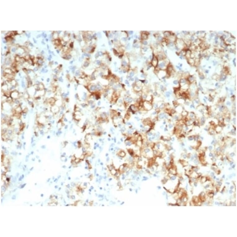 Immunohistochemistry - Anti-CDC20 Antibody [CDC20/7026R] (A278103) - Antibodies.com