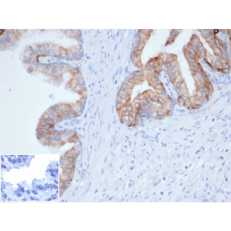 Immunohistochemistry - Anti-pan Cytokeratin Antibody [Cocktail PCK/4933R] (A278105) - Antibodies.com