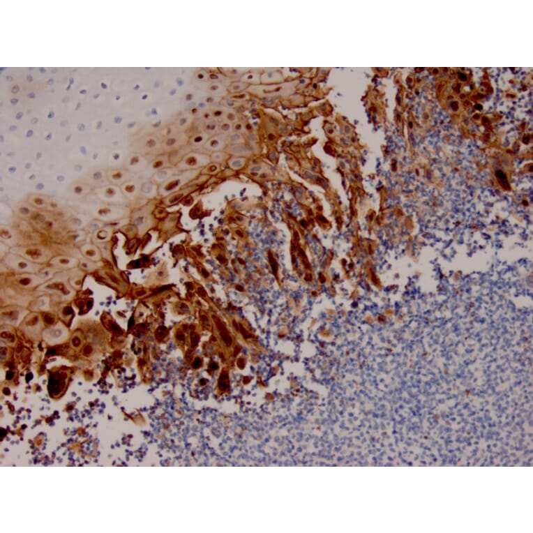 Immunohistochemistry - Anti-HSV1 Antibody [HSV1/4055R] (A278108) - Antibodies.com