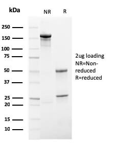 SDS-PAGE analysis of Anti-HSV1 Antibody [HSV1/4055R] under non-reduced and reduced conditions; showing intact IgG and intact heavy and light chains, respectively. SDS-PAGE analysis confirms the integrity and purity of the antibody.