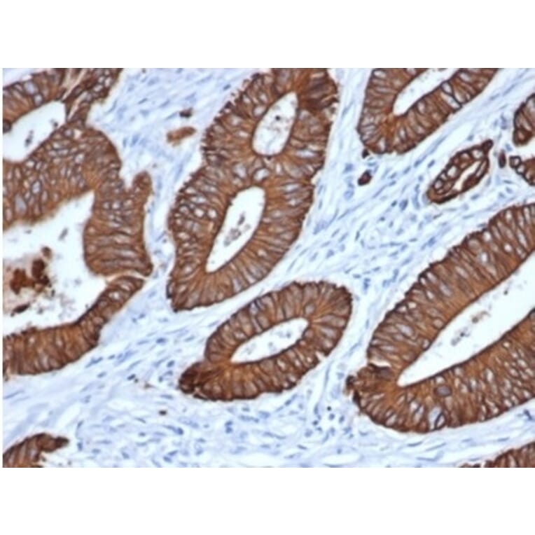 Immunohistochemistry - Anti-pan Cytokeratin Antibody [MonoPoly/7249R] (A278110) - Antibodies.com
